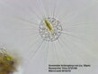 Actinophrys s mikroskopom Bresser Researcher Trino 40-1000x a kamerou Bresser MikroCam II 3MP