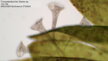 Trumpetum animalculum pod mikroskopom Bresser Bioscience Trino 40-1000x