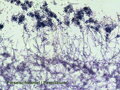 Pripravený preparát plesne Penicillium pod mikroskopom
