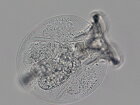 Mikroorganizmu cez mikroskop Bresser Science TRM-301 40-1000x
