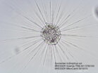 Actinophyida pod mikroskopom Bresser Science TRM-301 40-1000x s kamerou Bresser MikroCam II 3MP
